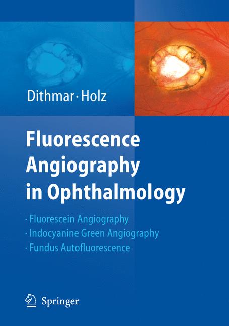 Fluorescence Angiog…