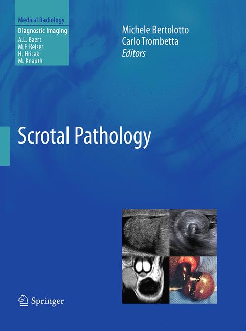 Scrotal Pathology - image