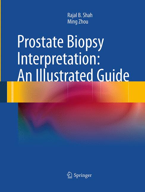 Prostate Biopsy Int…