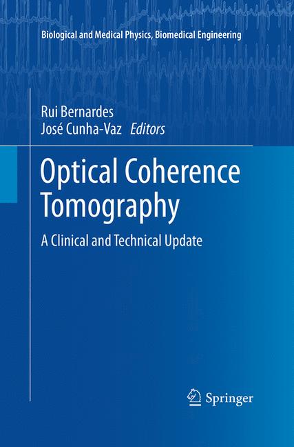 Optical Coherence T…