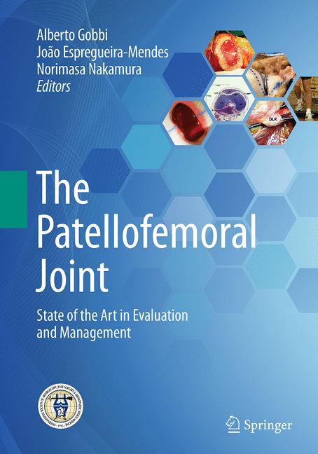 The Patellofemoral …