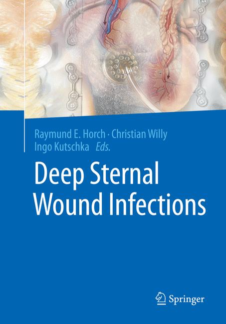 Deep Sternal Wound … - image