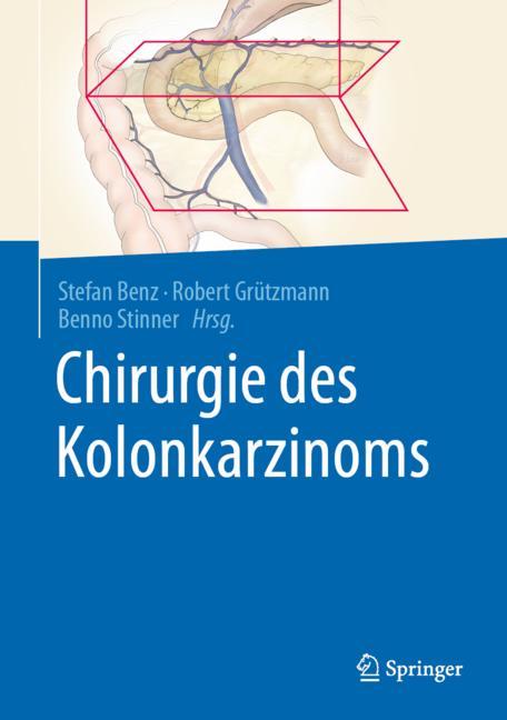 Chirurgie Des Kolon…