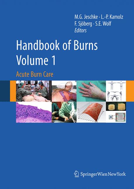 Handbook Of Burns V… - image