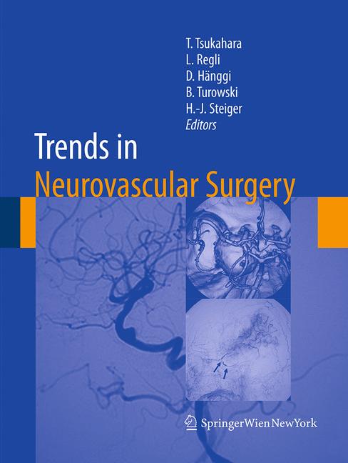 Trends In Neurovasc… - image