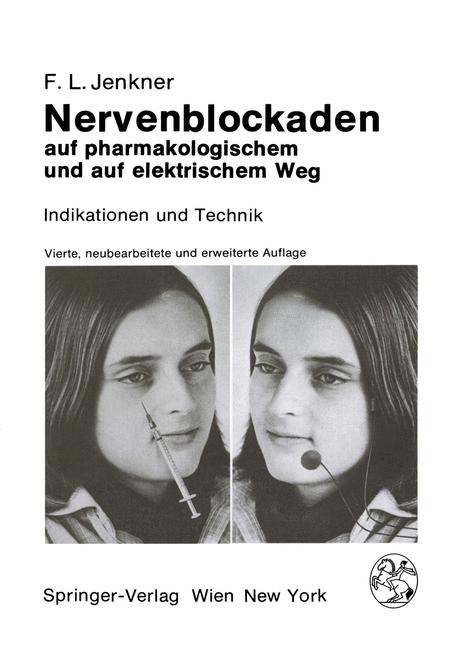 Nervenblockaden Auf…