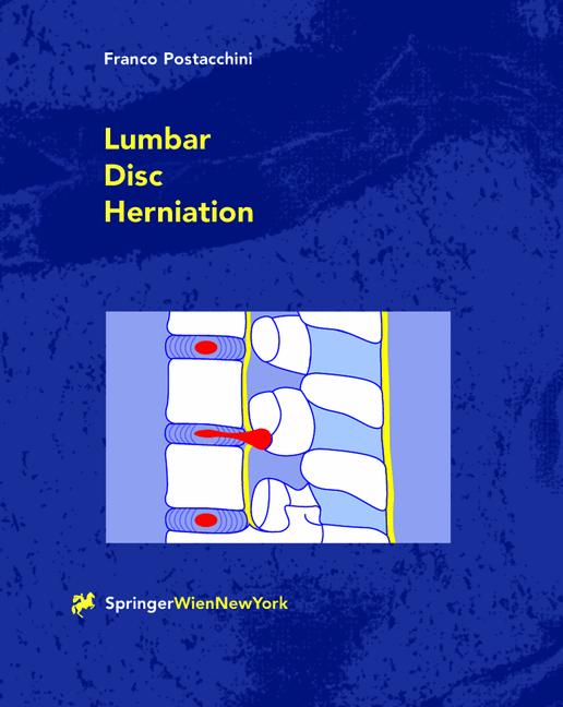 Lumbar Disc Herniat…