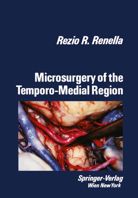 Microsurgery Of The Temporo-Medial Region