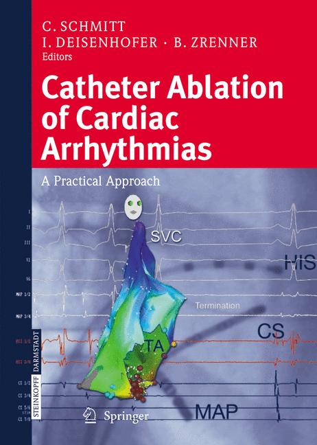 Catheter Ablation O… - image