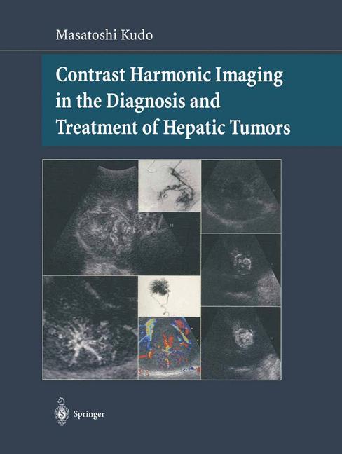 ISBN 9784431000020 product image for Contrast Harmonic Imaging in the Diagnosis and Treatment of Hepatic Tumors | upcitemdb.com