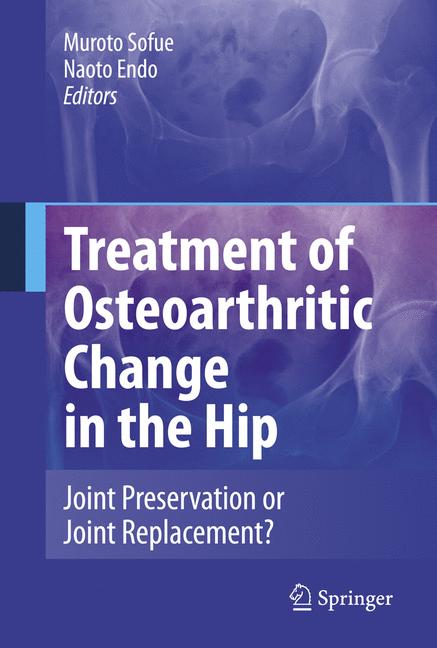 Treatment Of Osteoa… - image