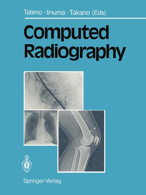 Computed Radiography - image
