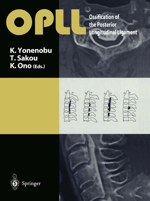 OPLL