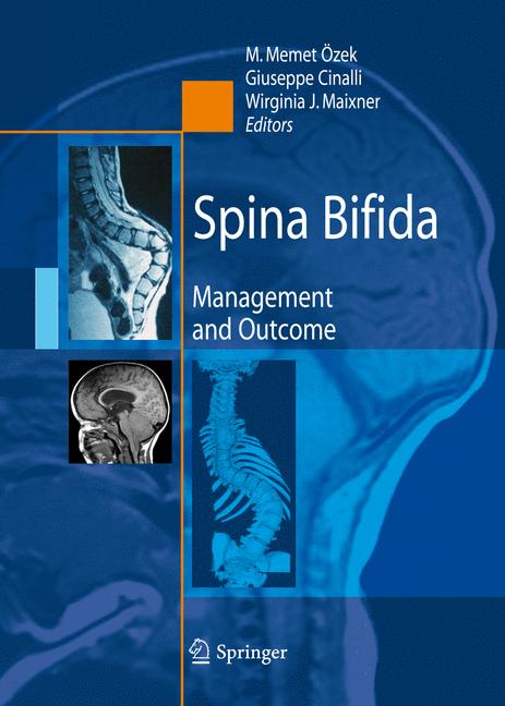 Spina Bifida