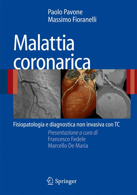 Malattia Coronarica - image