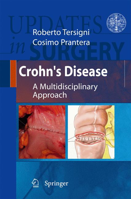 Crohn's Disease - image