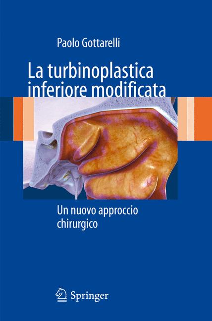 La Turbinoplastica … - image