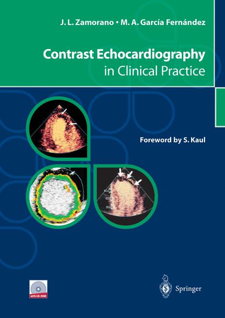 Contrast Echocardio… - image