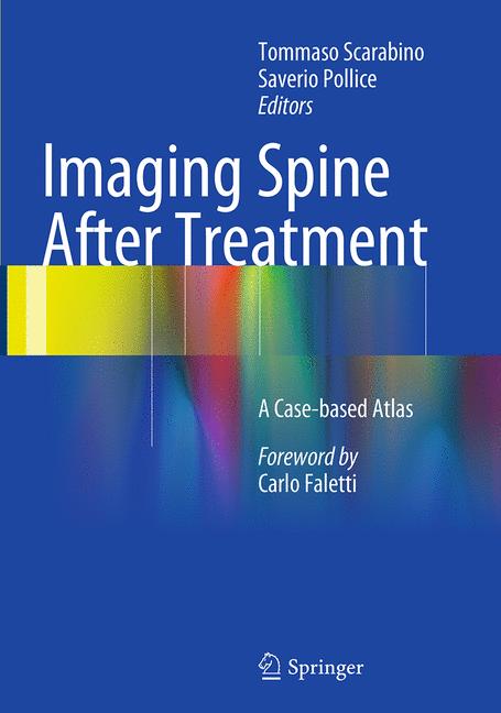 Imaging Spine After…