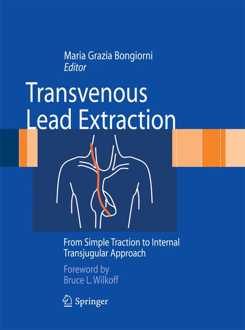 Transvenous Lead Ex…