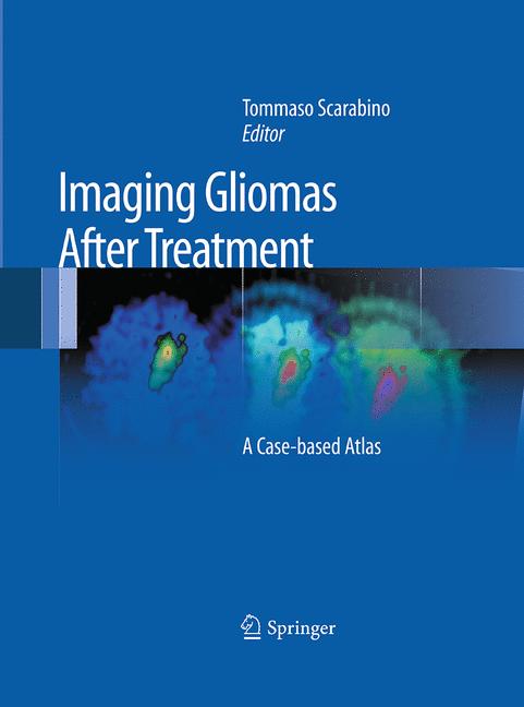 Imaging Gliomas Aft…