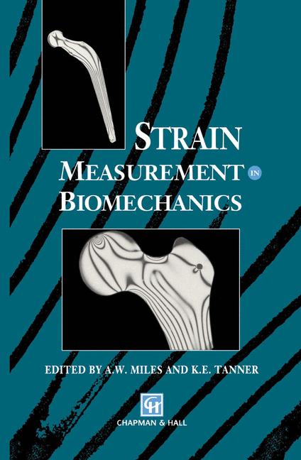 Strain Measurement …