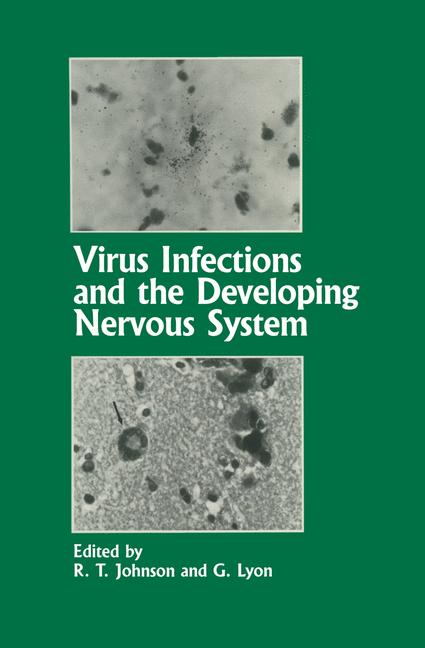 Virus Infections An… - image