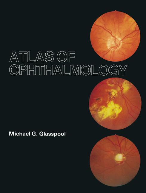 Atlas Of Ophthalmol… - image