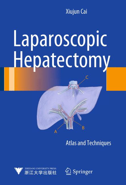 Laparoscopic Hepate… - image