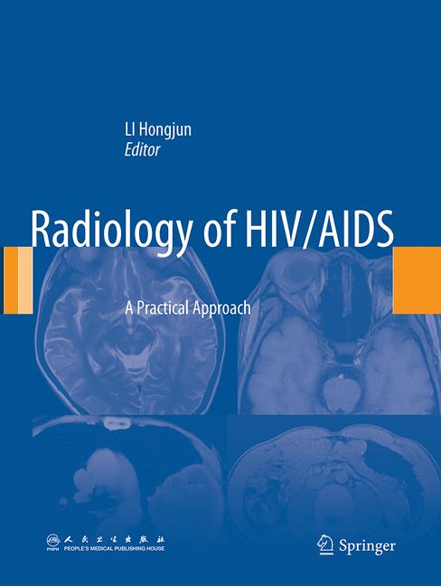 Radiology Of Hiv/Ai… - image