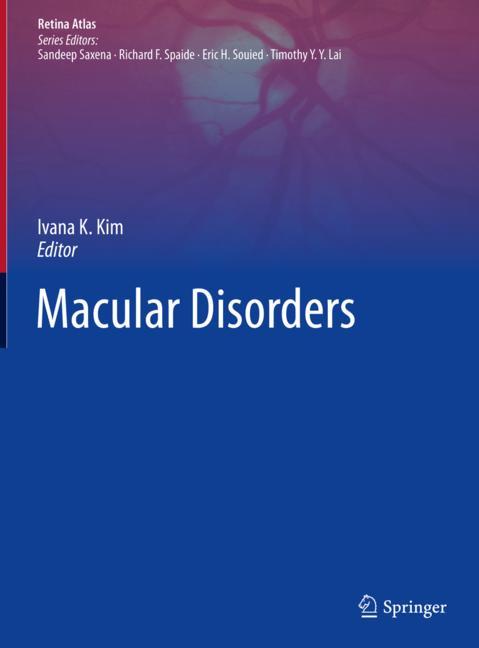 Macular Disorders - image