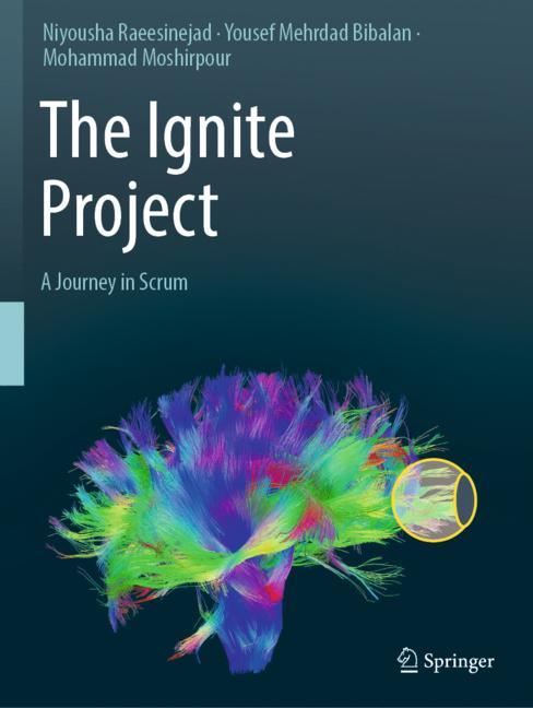 Ignite Project : A Journey in Scrum