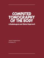Computed Tomography of the Body - Janet E. Husband; Ian Kelsey Fry