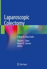 ISBN 9783030395599 product image for Laparoscopic Colectomy | upcitemdb.com