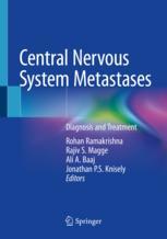 ISBN 9783030429607 product image for Central Nervous System Metastases | upcitemdb.com