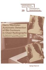 Automatic Detection of Rib Contours in Chest Radiographs - WECHSLER