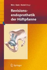 Revisionsendoprothetik der HÃ¼ftpfanne - Dieter C. Wirtz; Christof Rader; Heiko Reichel