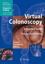 Virtual Colonoscopy - Albert L. Baert; Philippe Lefere; StefÃ an Gryspeerdt
