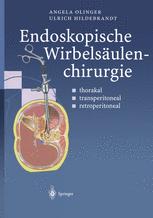 Endoskopische WirbelsÃ¤ulenchirurgie - Angela Olinger; M.D. Menger; B. Vollmar; Ulrich Hildebrandt