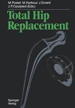 ISBN 9783642695995 product image for Total Hip Replacement | upcitemdb.com