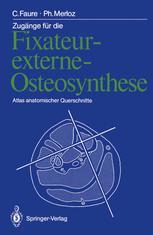 ZugÃ¤nge fÃ¼r die Fixateur-externe-Osteosynthese - Claude Faure; Thomas Lederer; Philippe Merloz