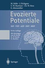 Evozierte Potentiale - H. Kroiss; R.-D. Treede; K. Ruether; Manfred StÃ¶hr; J. Dichgans; Ulrich W. Buettner; C.W. Hess; E. AltenmÃ¼ller