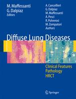 ISBN 9788847004306 product image for Diffuse Lung Diseases | upcitemdb.com