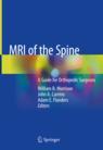 Front cover of MRI of the Spine