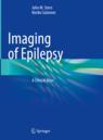 Front cover of Imaging of Epilepsy