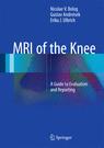 Front cover of MRI of the Knee