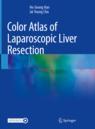 Front cover of Color Atlas of Laparoscopic Liver Resection