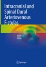 Front cover of Intracranial and Spinal Dural Arteriovenous Fistulas